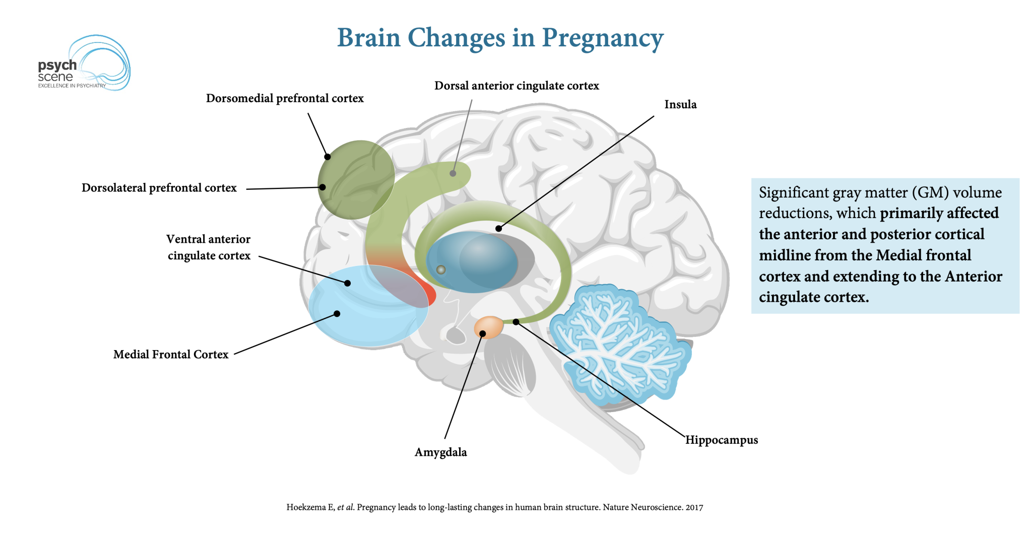 The Amazing Brain Changes in Pregnancy - Preparation for Motherhood